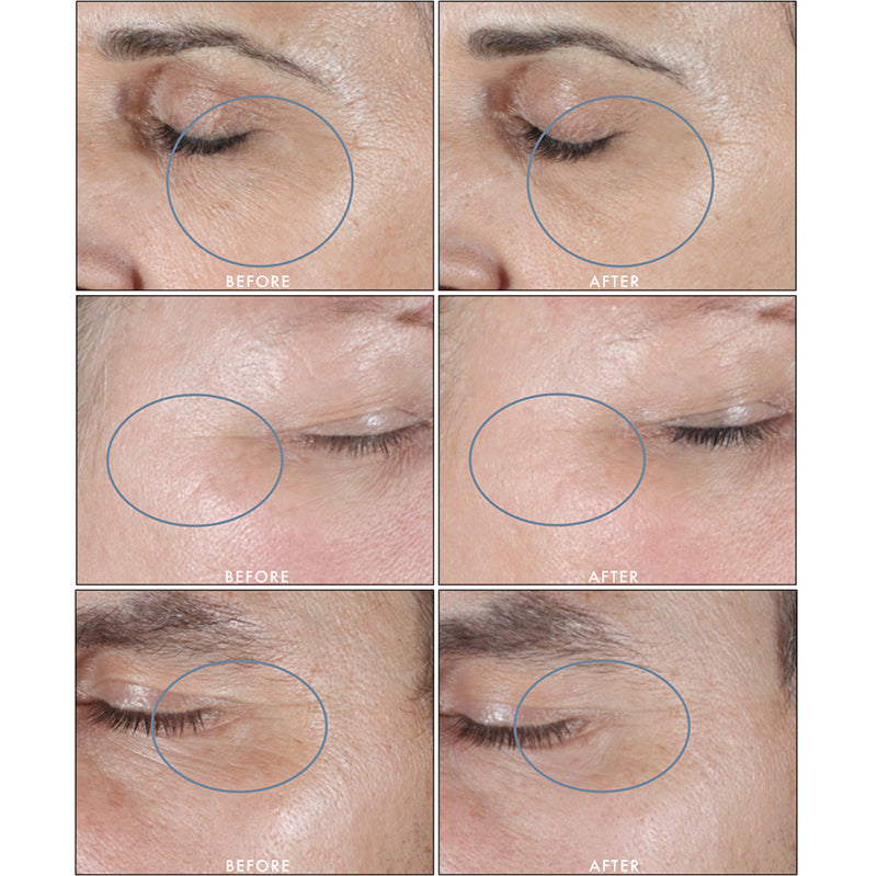 SkinMedica HA5 - INVU Skin | Regina, SK